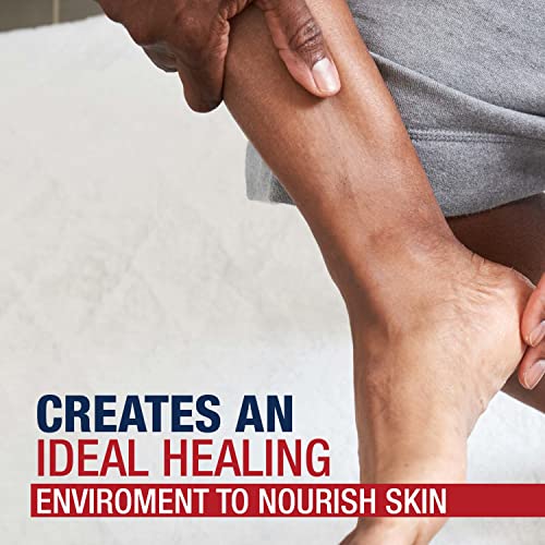 Aquaphor 46226 Healing Ointment, Skin Protection, 14 oz
