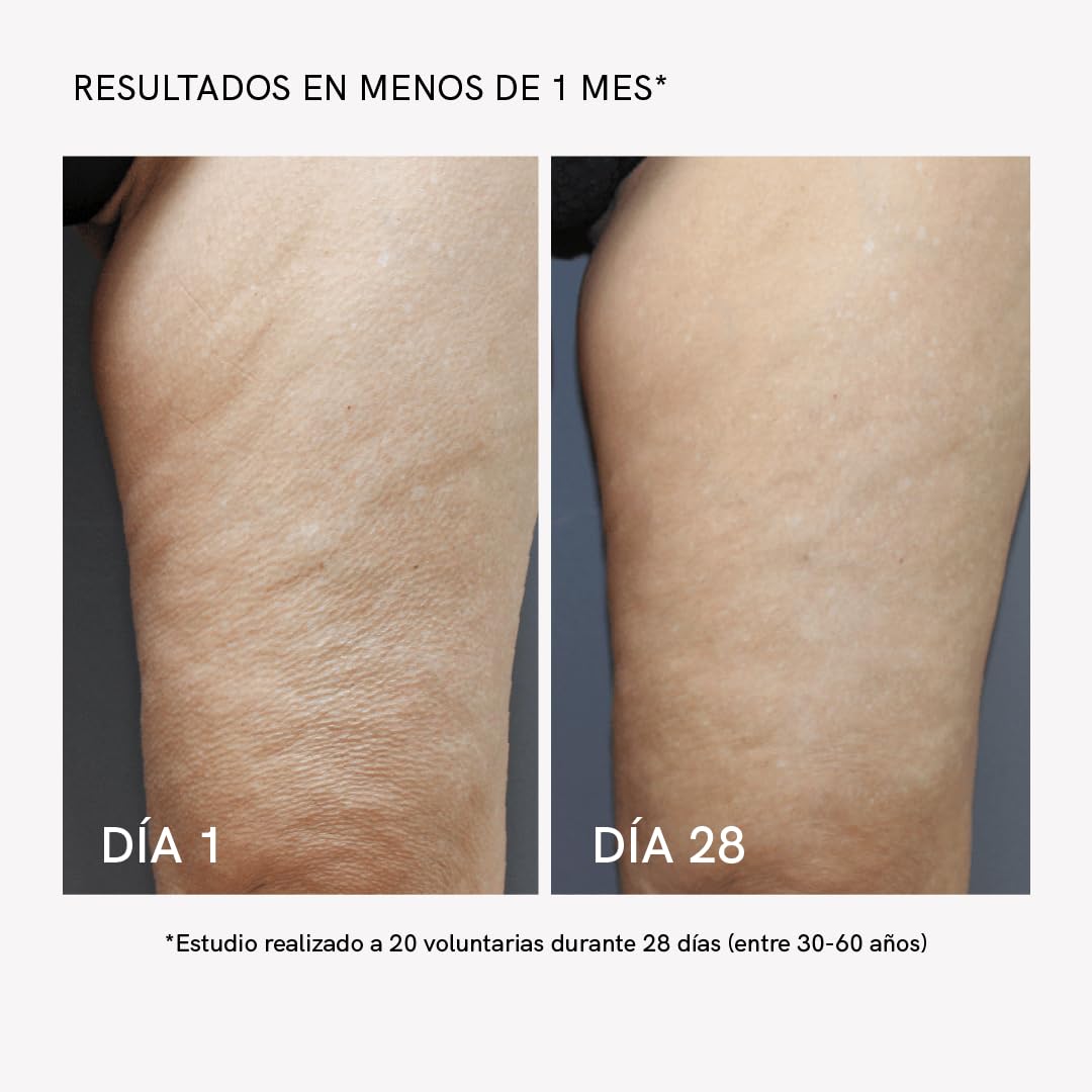 Gel-Crema Corporal Reafirmante Radiofrecuencia 1000ml - Masderm