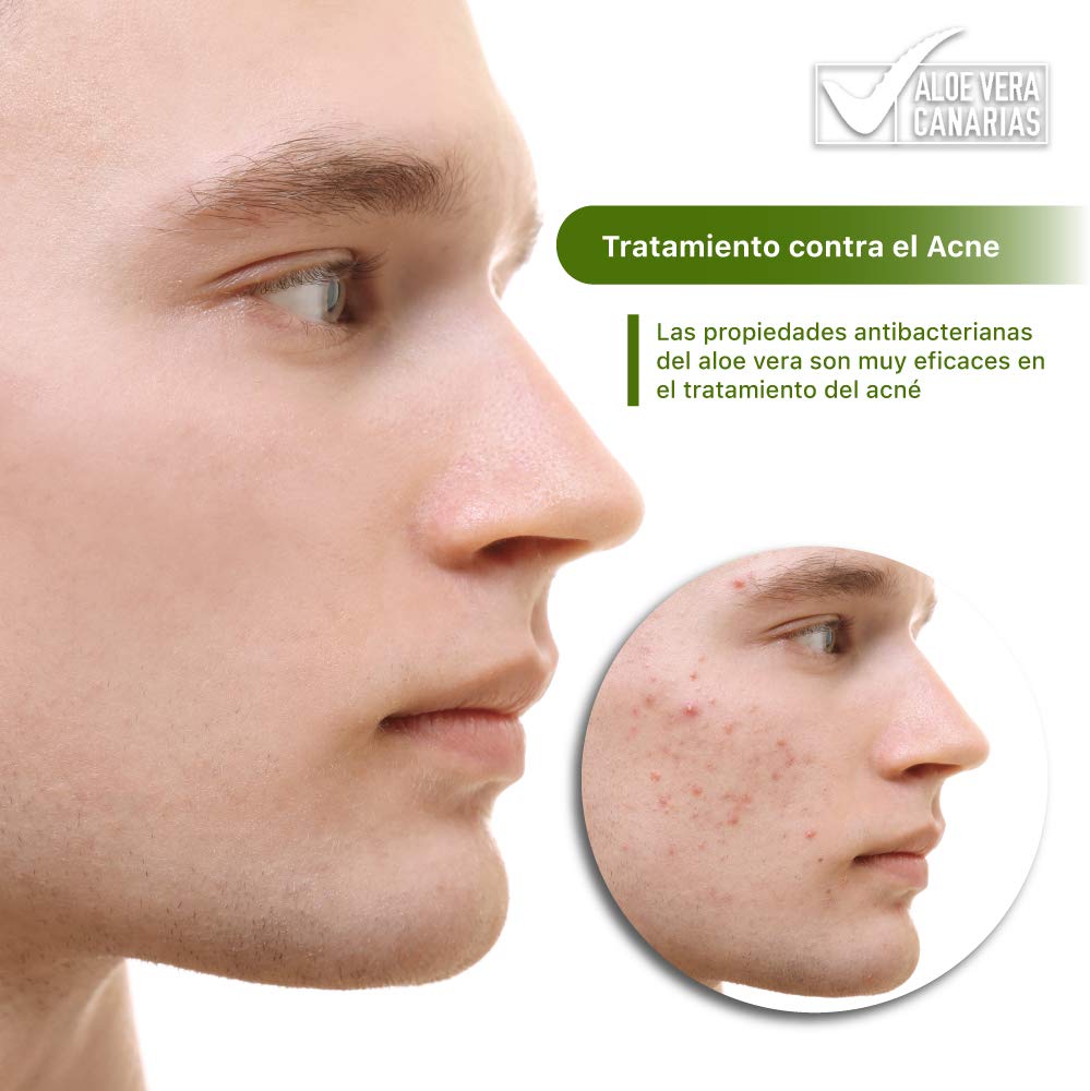 100% Aloe Vera Gel from the Canary Islands, natural moisturizing cream 500 ml for skin irritated by waxing and shaving/sunburn and insect bites. Facial and body use