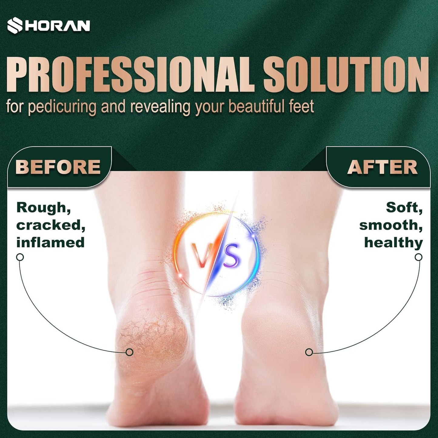 SHORAN Electric Foot File Hard Skin, Professional Pedicure Electric Callus Remover, Foot Machine for Exfoliating to Eliminate Hard Skin and Calluses, Rechargeable Foot File Hard Skin with 2 Foot Scrapers and 3 Rollers