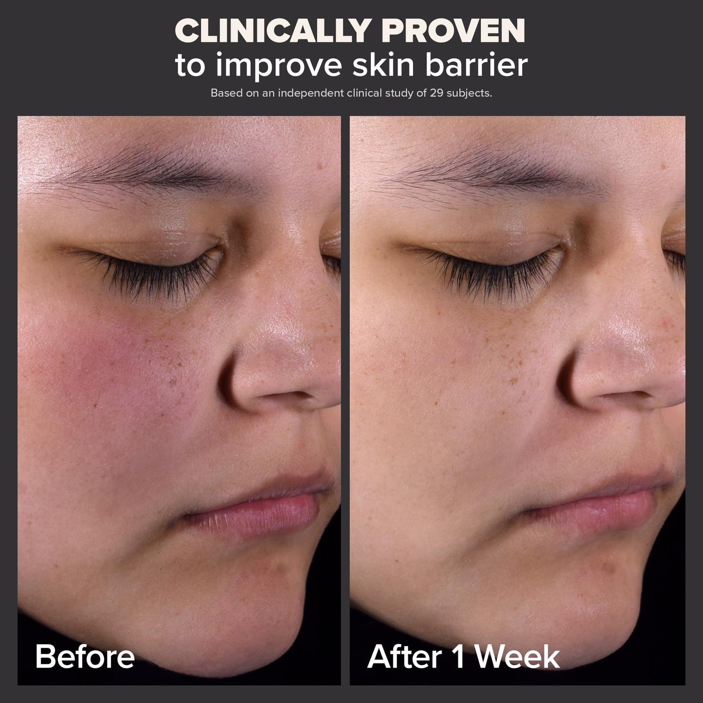 Paula's Choice Skin Perfecting 2% BHA Exfoliante Líquido - 30 ml