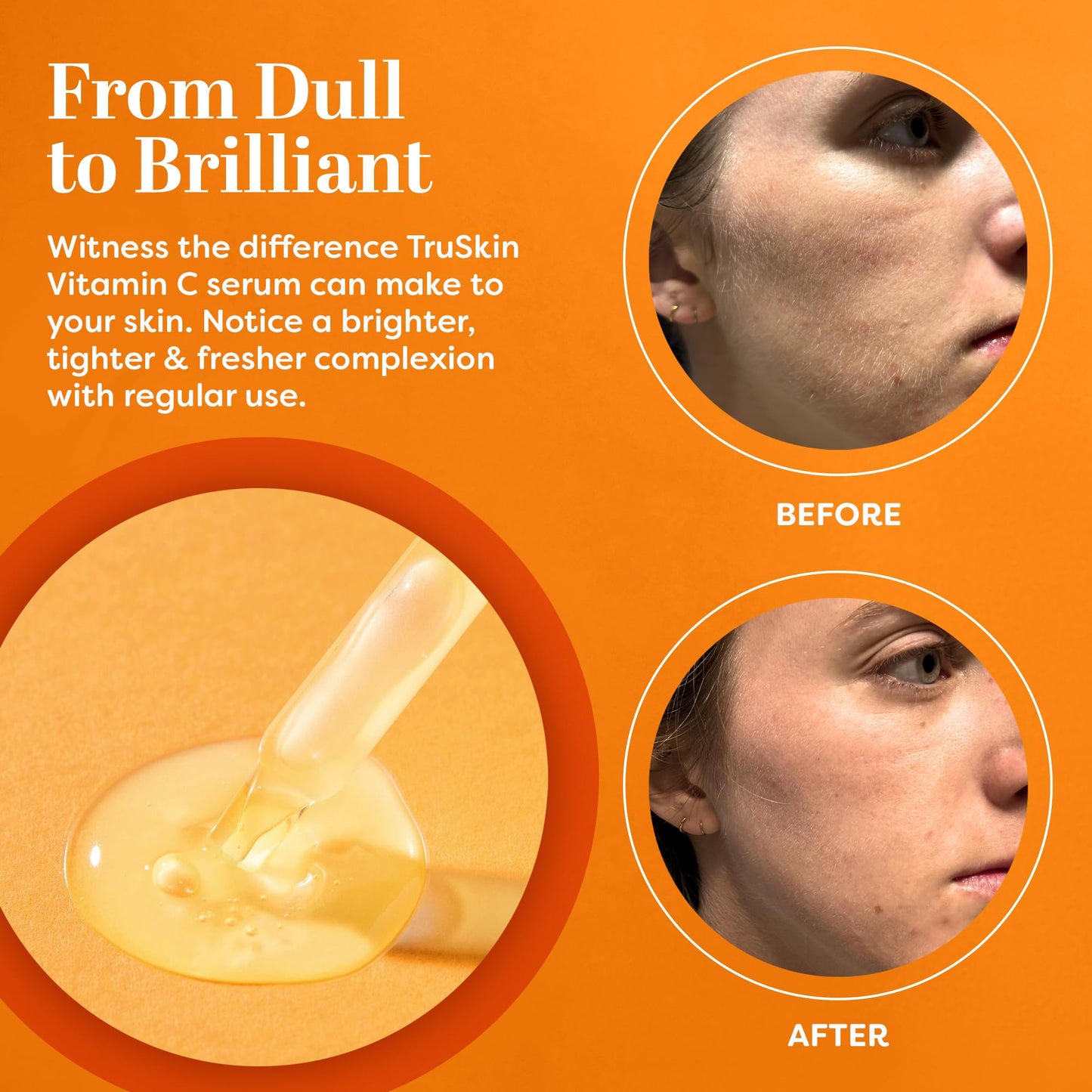 TruSkin Vitamin C Serum - Sérum anti-age à la vitamine C avec acide hyaluronique, vitamine E, aloès - Sérum éclaircissant pour les taches brunes, les ridules et les rides, 2 Fl Oz 60ml