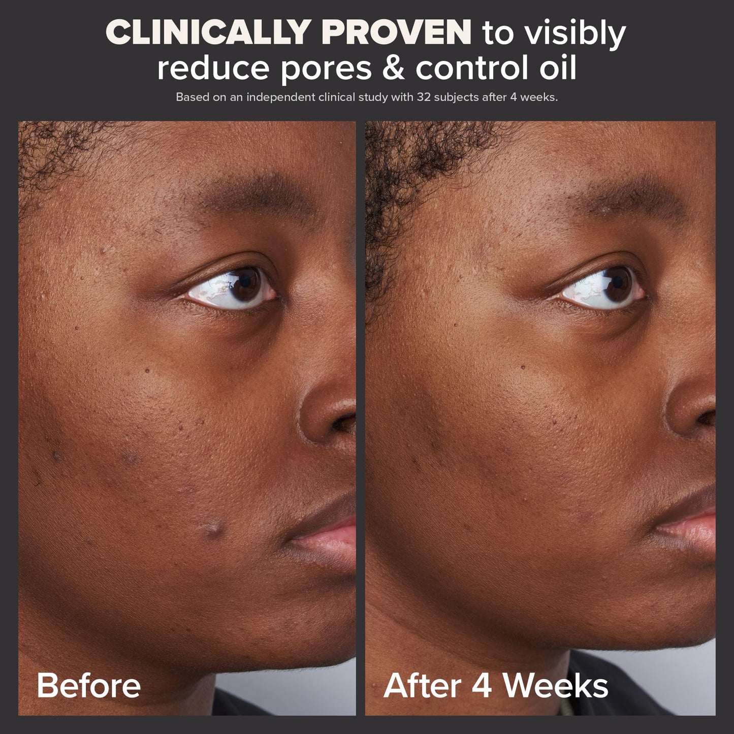 Paula's Choice Skin Perfecting 2% BHA Exfoliante Líquido - 30 ml