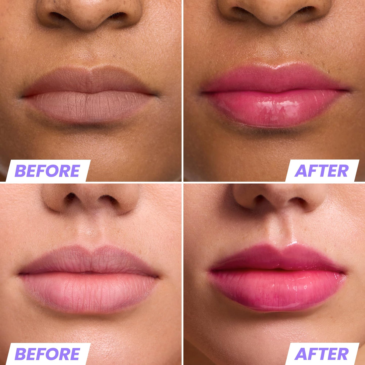 Wonderskin Lip Rehab Serum Oil – Aceite Labial Cambia de Color a Rosa Hidratante y No Pegajoso (Kissed)