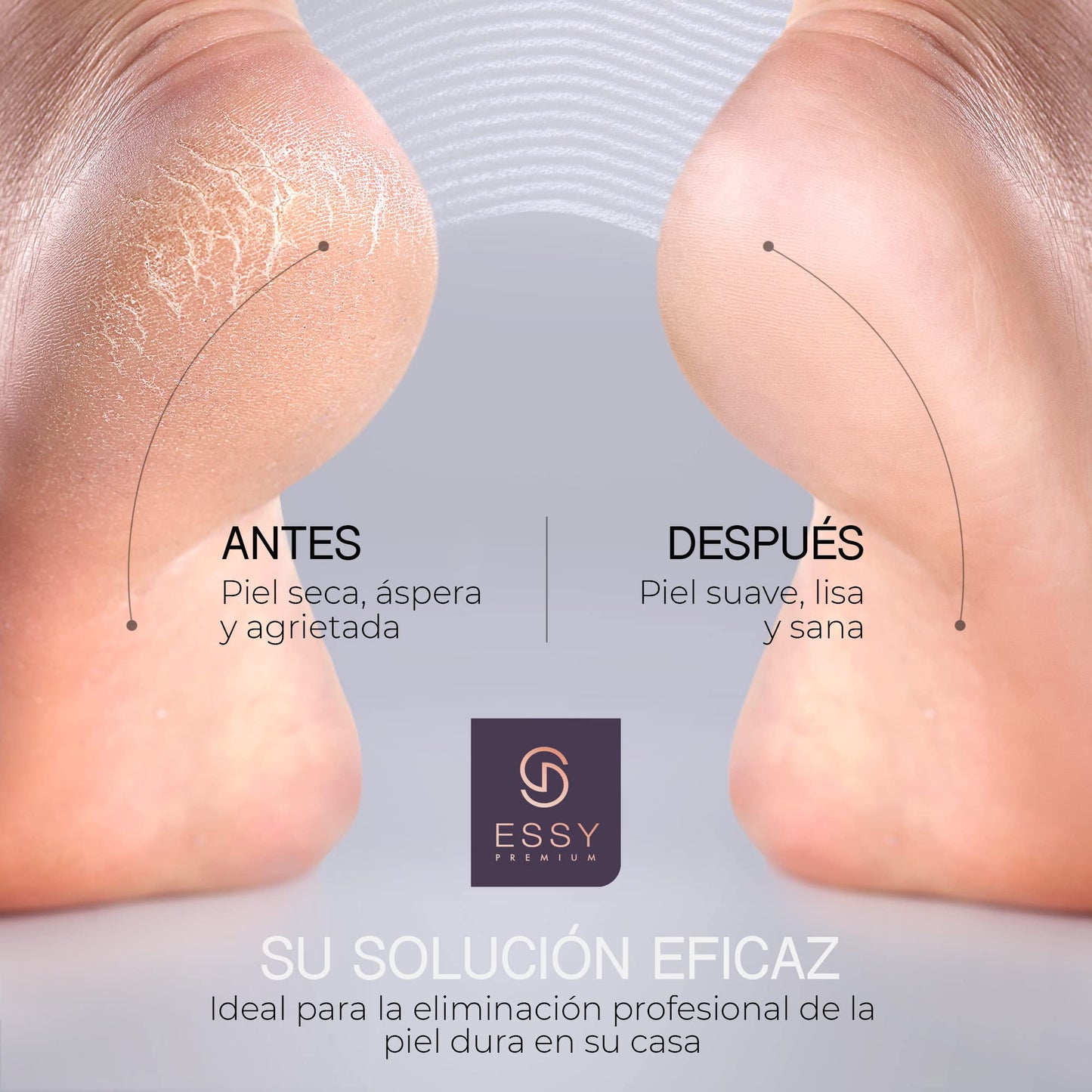 Lima Eléctrica Recargable Essy para Pies con 5 Rodillos - Morado
