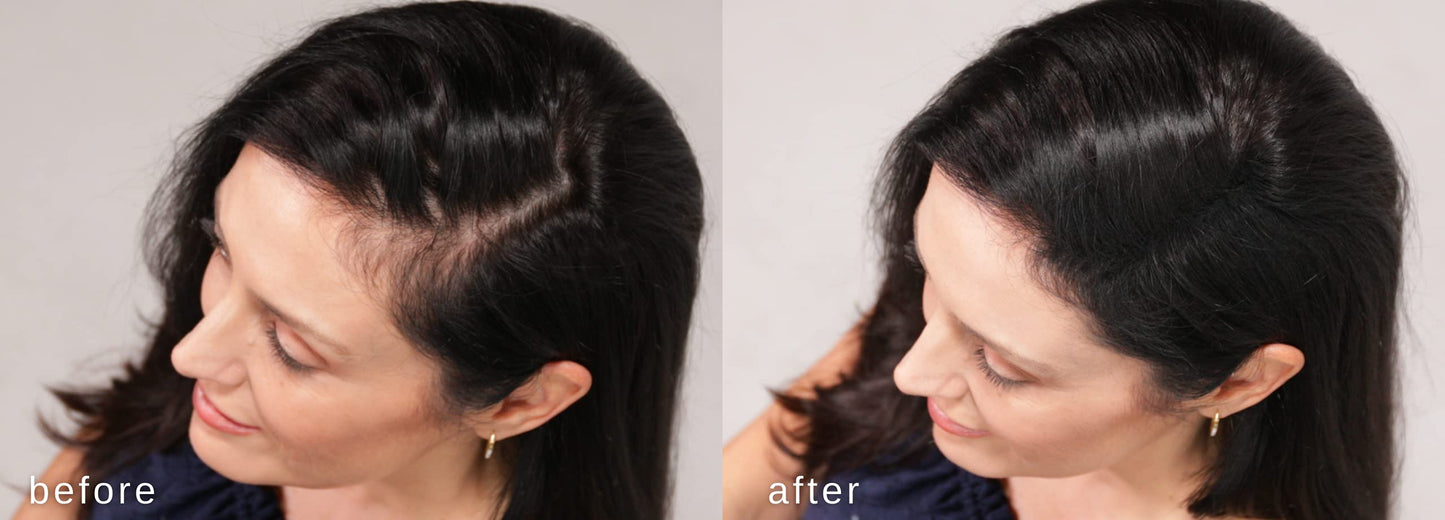 Fibras espesantes para el cabello LUXE con queratina natural - ¡Tratamiento para 2 meses! - Probado por dermatólogos - Hipoalergénico - Multiples colores disponibles. Negro