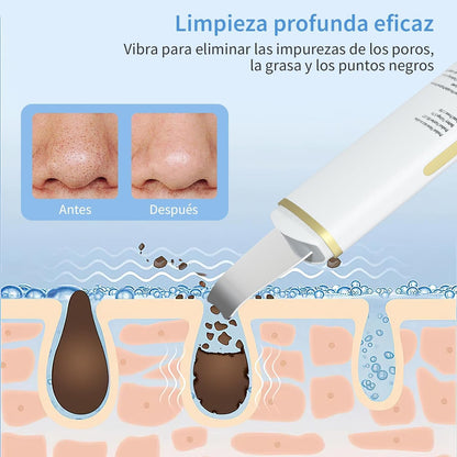 GUGUG Peeling Ultrasónico Facial, Skin Scrubber, Limpiador Facial, Exfoliación de Cara 4 Modos para Limpiar los Poros y Cuidar la Piel, USB Recargable, Dispositivo de Belleza