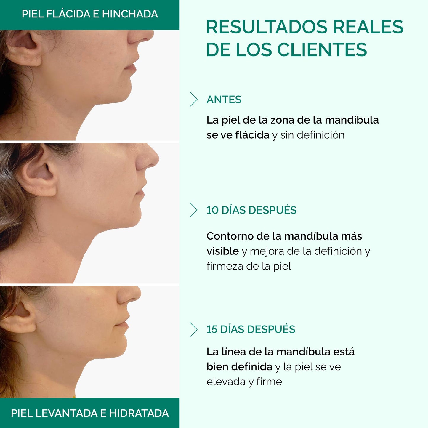 PLANTIFIQUE Mascarilla Facial V-Line - Lifting y Reductor de Papada